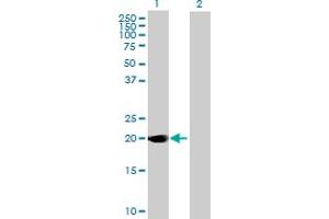 Western Blot analysis of DUSP14 expression in transfected 293T cell line by DUSP14 MaxPab polyclonal antibody. (DUSP14 antibody  (AA 1-198))