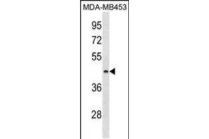 Western blot analysis in MDA-MB453 cell line lysates (35ug/lane). (ALG8 antibody  (N-Term))