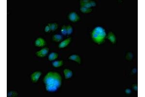 Immunofluorescent analysis of MCF-7 cells using ABIN7152042 at dilution of 1:100 and Alexa Fluor 488-congugated AffiniPure Goat Anti-Rabbit IgG(H+L) (Estrogen Receptor alpha antibody  (AA 10-591))