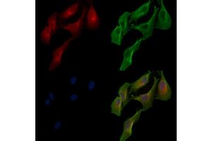 ABIN7094332 and ABIN7098379 staining  cells by IF/ICC. (LACTB antibody  (Internal Region))