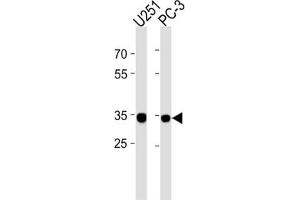 Western Blotting (WB) image for anti-Ribosomal Protein, Large, P0 Pseudogene 6 (RPLP0P6) antibody (ABIN3004613) (RPLP0P6 antibody)