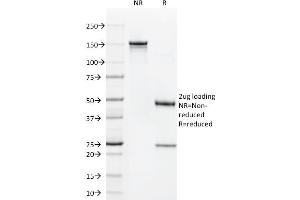 SDS-PAGE Analysis Purified CD1a Mouse Monoclonal Antibody (C1A/711). (CD1a antibody)