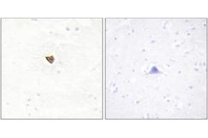 Immunohistochemistry analysis of paraffin-embedded human brain tissue, using JAKMIP2 Antibody. (JAKMIP2 antibody  (AA 761-810))