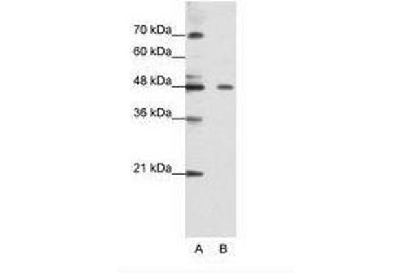 ZNF645 antibody  (N-Term)