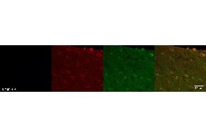 Immunohistochemistry (IHC) image for anti-Doublecortin Domain Containing 2 (DCDC2) antibody (ABIN7456335) (DCDC2 antibody)