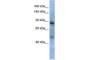 WB Suggested Anti-ZHX3 Antibody Titration: 0. (ZHX3 antibody  (Middle Region))