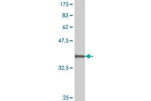 Western Blot detection against Immunogen (37. (Dystonin antibody  (AA 401-500))