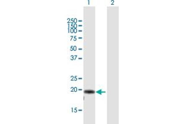 AP3S2 Antikörper  (AA 1-193)