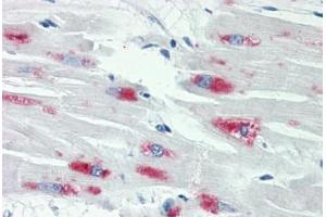 Human Heart: Formalin-Fixed, Paraffin-Embedded (FFPE) (Smad2/3 antibody  (AA 1-50))