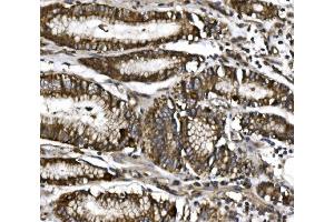 IHC analysis of MitoNEET/CISD1 using anti-MitoNEET/CISD1 antibody (ABIN7601089). (CISD1 antibody  (AA 28-93))
