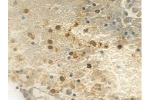 ABIN6259186 and ABIN6275604 at 1/100 staining human pituitary adenoma by IHC-P.