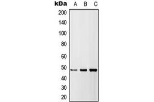 Western blot analysis of DR5 expression in HEK293T (A), A549 (B), H9C2 (C) whole cell lysates. (TNFRSF10B antibody  (Center))
