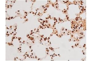Immunohistochemistry (IHC) image for anti-REL proto-oncogene (c-Rel) (pSer503) antibody (ABIN6255382)