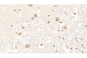 Immunohistochemistry (IHC) image for anti-Fibrinogen beta Chain (FGB) (AA 45-491) antibody (ABIN7428047)