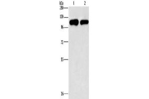 Gel: 10 % SDS-PAGE, Lysate: 40 μg, Lane 1-2: A431 cells, hela cells, Primary antibody: ABIN7191891(PIP5K1C Antibody) at dilution 1/500, Secondary antibody: Goat anti rabbit IgG at 1/8000 dilution, Exposure time: 2 minutes (PIP5K1C antibody)