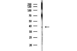 anti-Ataxin 7-Like 3 (ATXN7L3) (Internal Region) antibody