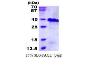 Image no. 1 for Ring Finger Protein 4 (RNF4) protein (His tag) (ABIN1098423)