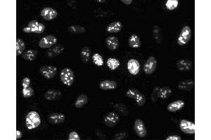 Immunofluorescent staining of HeLa cells. (Ki-67 antibody)