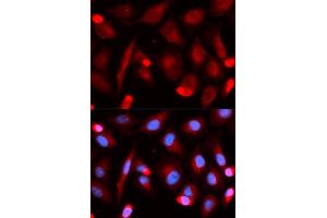 Immunofluorescence (IF) image for anti-Friend Leukemia Virus Integration 1 (FLI1) antibody (ABIN1876845) (FLI1 antibody)