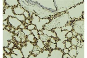 ABIN6268895 at 1/100 staining Mouse lung tissue by IHC-P. (HDAC5 antibody  (C-Term))