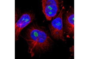Immunofluorescent staining of human cell line U-251 MG with TNFAIP1 polyclonal antibody  shows positivity in nucleoli. (TNFAIP1 antibody  (AA 80-170))