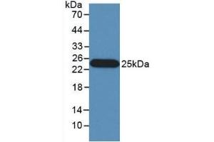 IFNB1 antibody