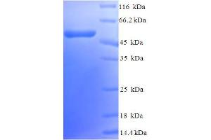 SDS-PAGE (SDS) image for Calponin 1 (CNN1) (AA 1-297), (full length) protein (His-SUMO Tag) (ABIN4975710)