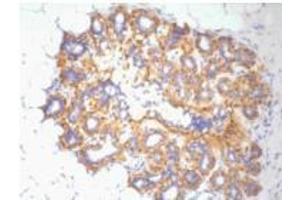 Immunohistochemistry (IHC) staining of Human ovary tissue, diluted at 1:200 (beta Actin antibody)