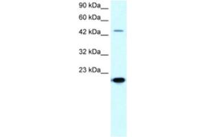 Western Blotting (WB) image for anti-Matrix Metallopeptidase 19 (MMP19) antibody (ABIN2460424) (MMP19 antibody)