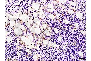 Formalin-fixed and paraffin embedded rat lymphoma tissue labeled Anti-Ang-2/Angiopoietin-2 Polyclonal Antibody, Unconjugated (ABIN671781) at 1:200, followed by conjugation to the secondary antibody and DAB staining (Angiopoietin 2 antibody  (AA 401-496))
