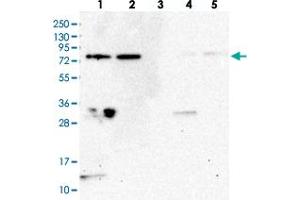 Western blot analysis of Lane 1: RT-4, Lane 2: U-251 MG, Lane 3: Human Plasma, Lane 4: Liver, Lane 5: Tonsil with WDR48 polyclonal antibody  at 1:250-1:500 dilution. (WDR48 antibody)