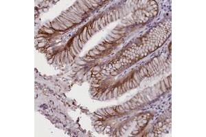 Immunohistochemical staining of human stomach with RTTN polyclonal antibody  shows moderate cytoplasmic positivity in glandular cells.