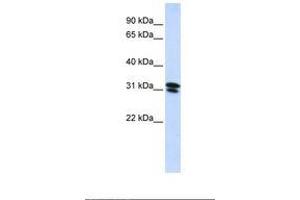 Image no. 1 for anti-Ring Finger Protein 182 (RNF182) (AA 72-121) antibody (ABIN6739169) (RNF182 antibody  (AA 72-121))