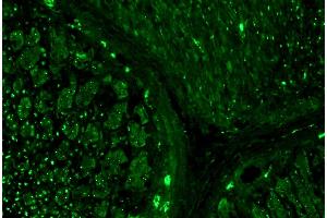 Immunohistochemistry (Paraffin-embedded Sections) (IHC (p)) image for anti-alpha Tubulin (TUBA1) antibody (ABIN93894)