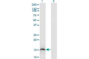 Western Blot analysis of RBP2 expression in transfected 293T cell line by RBP2 monoclonal antibody (M02), clone 3G12. (RBP2 antibody  (AA 45-134))