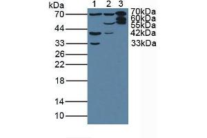 Figure. (Plastin 3 antibody  (AA 379-630))