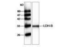 Image no. 1 for anti-Lactate Dehydrogenase B (LDHB) antibody (ABIN791438) (LDHB antibody)