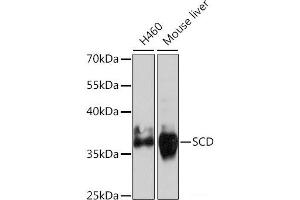 Western blot analysis of extracts of various cell lines using SCD Polyclonal Antibody at dilution of 1:1000. (SCD antibody)