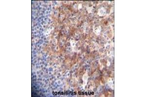 RCO Antibody (N-term) A immunohistochemistry analysis in forlin fixed and paraffin embedded hun tonsillitis tissue followed by peroxidase conjugation of the secondary antibody and DAB staining. (MARCO antibody  (AA 13-40))