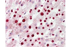 Human, Liver: Formalin-Fixed Paraffin-Embedded (FFPE). (NR2F6 antibody  (N-Term))