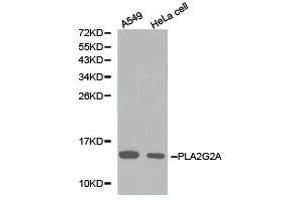 Western Blotting (WB) image for anti-Phospholipase A2, Group IIA (Platelets, Synovial Fluid) (PLA2G2A) antibody (ABIN1874153)