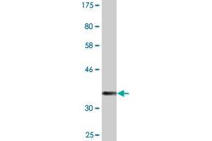 Western Blot detection against Immunogen (34. (Keratin 71 antibody  (AA 251-332))