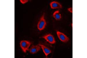 Immunofluorescent analysis of mGLUR6 staining in NIH3T3 cells. (Metabotropic Glutamate Receptor 6 antibody  (C-Term))
