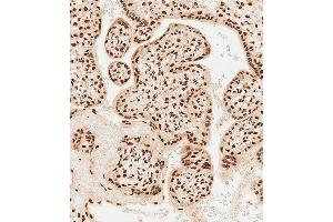 Immunohistochemical analysis of paraffin-embedded Human placenta tissue using (ABIN1537918 and ABIN2849884) performed on the Leica® BOND RXm. (MEOX2 antibody  (AA 164-192))