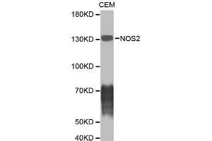 Western blot analysis of CEM cell lysate using NOS2 antibody. (NOS2 antibody)