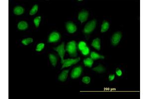 Immunofluorescence of purified MaxPab antibody to DDX20 on HeLa cell. (DDX20 antibody  (AA 1-824))