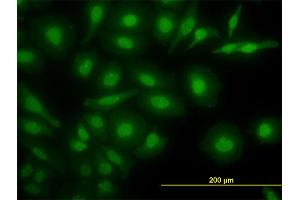Immunofluorescence of monoclonal antibody to NR4A2 on HeLa cell. (NR4A2 antibody  (AA 71-170))