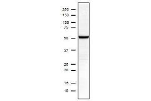 Influenza Nucleoprotein antibody (Influenza A Virus H2N2) (H1N1), (H2N2), (H3N2), (H5N1), (H5N2)