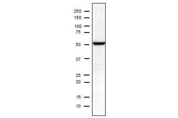 Influenza Nucleoprotein antibody (Influenza A Virus H2N2) (H1N1), (H2N2), (H3N2), (H5N1), (H5N2)