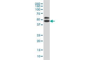 GDI1 monoclonal antibody (M08), clone 1H3 Western Blot analysis of GDI1 expression in IMR-32 . (GDI1 antibody  (AA 1-447))